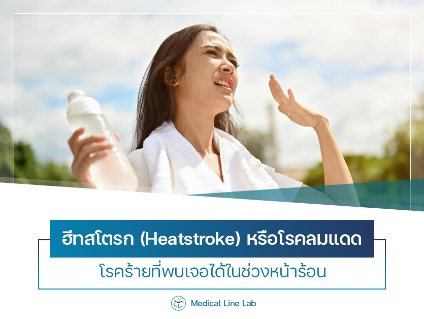 ฮีทสโตรก (Heatstroke) หรือโรคลมแดด โรคร้ายที่พบเจอได้ในช่วงหน้าร้อน