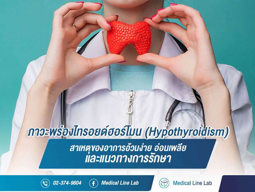 ภาวะพร่องไทรอยด์ฮอร์โมน (Hypothyroidism) คืออะไร?