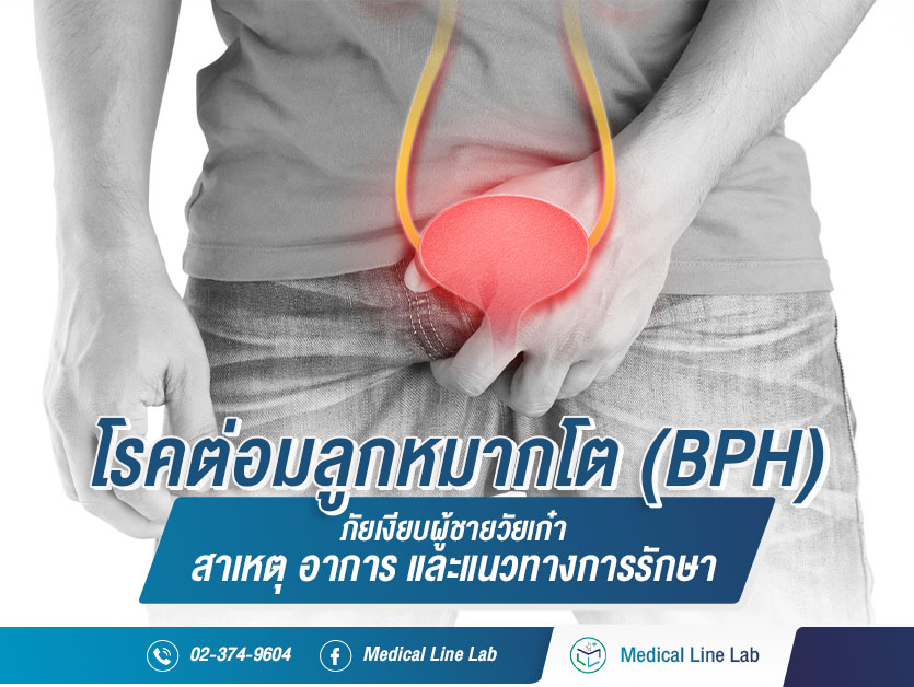 โรคต่อมลูกหมากโต (BPH) คืออะไร? ภัยเงียบผู้ชายวัยเก๋า